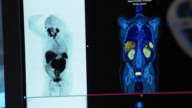 He initially put his pain down to a racing injury before scans showed cancer.