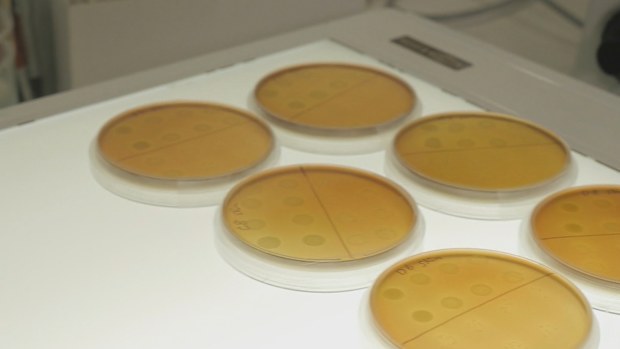 Group A streptococcus rise in Queensland. Strep A infections.