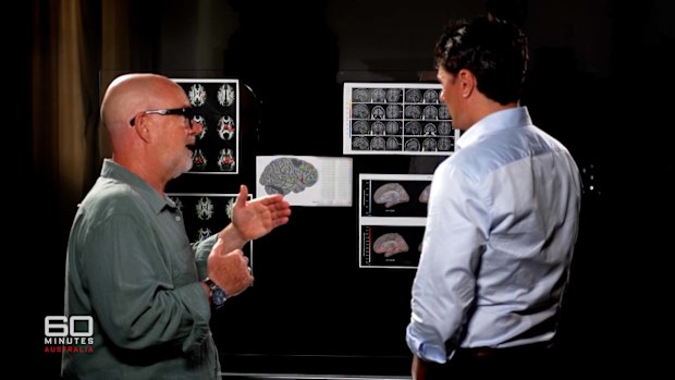 Doomscrolling habits giving lasting brain rot effects