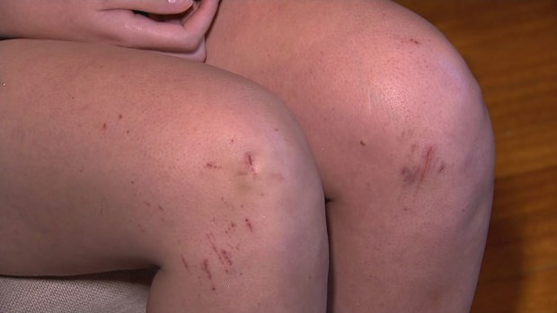 A woman who escaped an attack on a Queensland walking trail last week has warned others not to run alone. Alana, who did not wish to provide her surname, had been walking with headphones on along Mt Coot-tha's Maculata trail on Friday when she was struck.