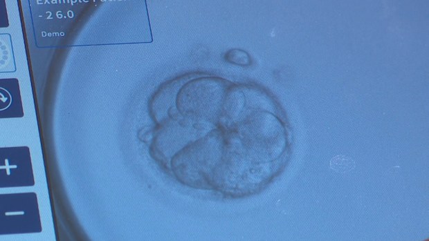 The fertility rebate was an Australian first introduced by the previous Berejiklian Government. 
