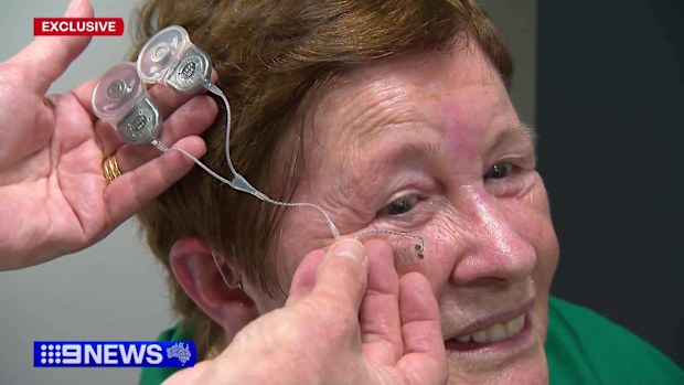 Bionic eye trial restoring 'sense of sight' to small group of ...