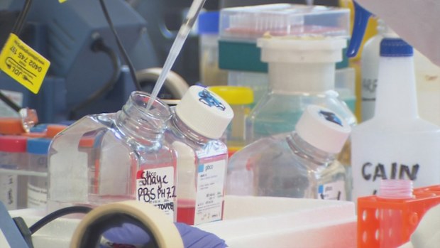 A team of doctors from Clayton's Husdon Institute have collected over 300 samples of children's tumour cells to develop a digital collection of research, called the Childhood Cancer Model Atlas.