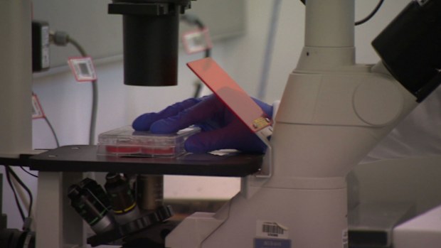 The trial aims to tailor treatment to patients and improve broader outcomes for multiple cancers within our lifetime.