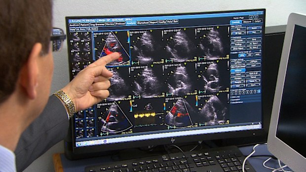 Australians with underlying heart issues could find themselves in hospital this winter as the colder temperatures take their toll. 