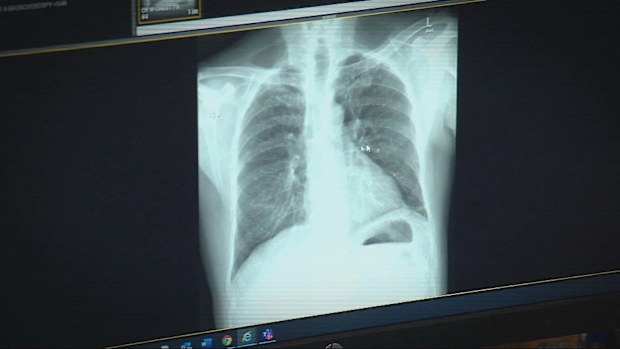 Workers in underground tunnels expected to contract silicosis, new study finds