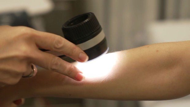 Many are avoiding getting skin checks due to surging costs for doctor appointments.