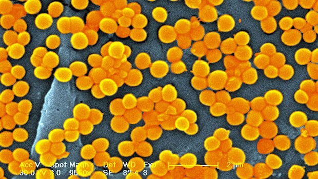 A new study projects that nearly 40 million people could die from antibiotic-resistant infections between now and 2050.