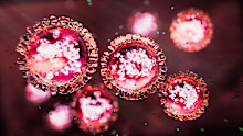 Measles is circulating in New South Wales, Queensland and Victoria.