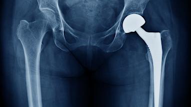 No. 15 - X-rays
