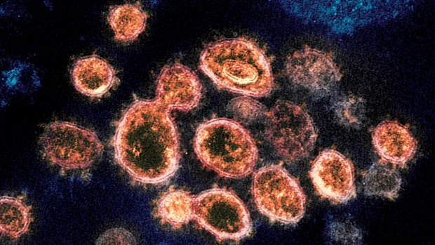 This electron microscope image shows SARS-CoV-2 virus particles which cause COVID-19.