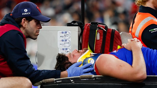 MELBOURNE, AUSTRALIA - SEPTEMBER 07: Angus Brayshaw of the Demons leaves the field on a stretcher during the 2023 AFL First Qualifying Final match between the Collingwood Magpies and the Melbourne Demons at Melbourne Cricket Ground on September 07, 2023 in Melbourne, Australia. (Photo by Dylan Burns/AFL Photos via Getty Images)