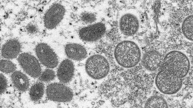 This electron microscopic (EM) image depicted a monkeypox virion, obtained from a clinical sample associated with the 2003 prairie dog outbreak. It was a thin section image from of a human skin sample. On the left were mature, oval-shaped virus particles, and on the right were the crescents, and spherical particles of immature virions. High Resolution:	Click here for hi-resolution image (5.21 MB) Content Providers(s):	CDC/ Cynthia S. Goldsmith Creation Date:	2003 Photo Credit:	Cynthia S. Goldsmi