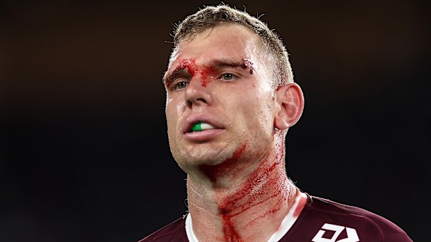 Tom Trbojevic of the Sea Eagles.