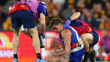 Liberatore was concussed in the last term against Hawthorn.