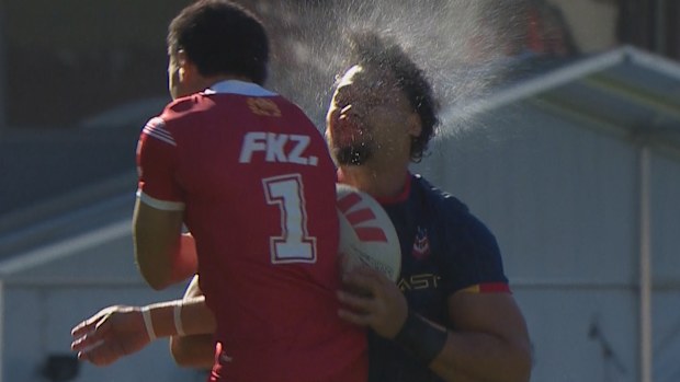 Eli Katoa antrenmanda sert bir darbe alıyor.