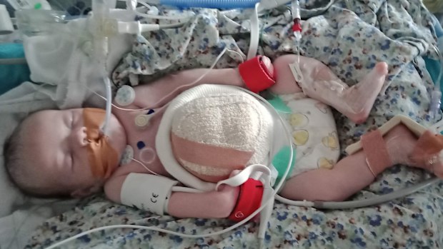 Children's health: Baby born with organs outside body could finally ...