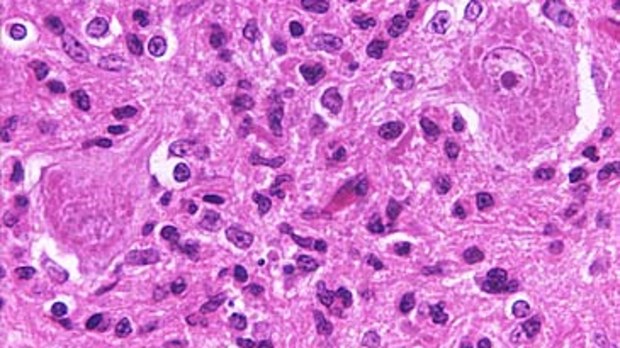 Scan of tissue infected with rabies (Getty)
