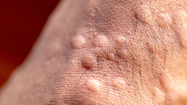 Red fire ants, which survived floodwaters in south-east Queensland earlier this month, are feared to be hitching a ride on vehicles travelling across borders and leaving people with painful bites. 