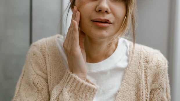 Stock image of a woman with a bruised face, domestic abuse.