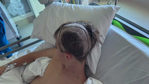 Theo Phillips is now recovering after undergoing two brain surgeries.