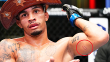 Andre Lima shows a bite mark on his arm following a UFC fight.