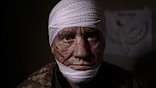 At a medical stabilisation point in Bakhmut, Ukrainian soldier Oleh Nazarov, 51, has sustained head, neck, back injuries from a grenade attack on his trench. 