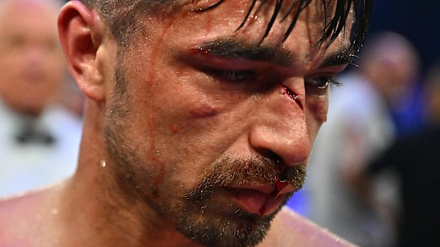 Jonathan Navarro looks on after his fight against Liam Paro in their welterweight bout at Cairns Convention Centre on June 25, 2025 in Cairns, Australia. (Photo by Emily Barker/Getty Images for No Limit Boxing)