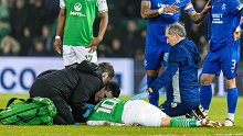 Hibernian's Martin Boyle receives medical treatment after going down injured.