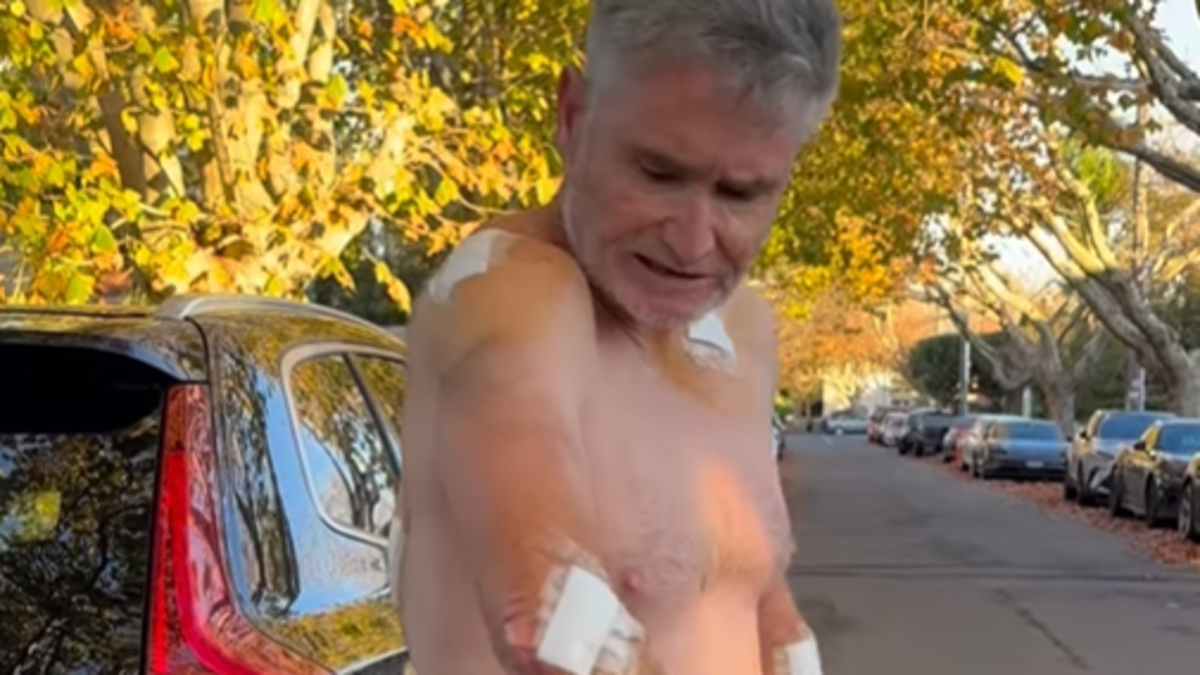 Dave Hughes skin cancer: Hughesy emerges with five bandages, 45 stitches after latest removal