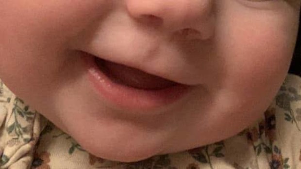 The face of Reanna Bendzak's daughter before her awful 'margarita burns' from her celery snack.