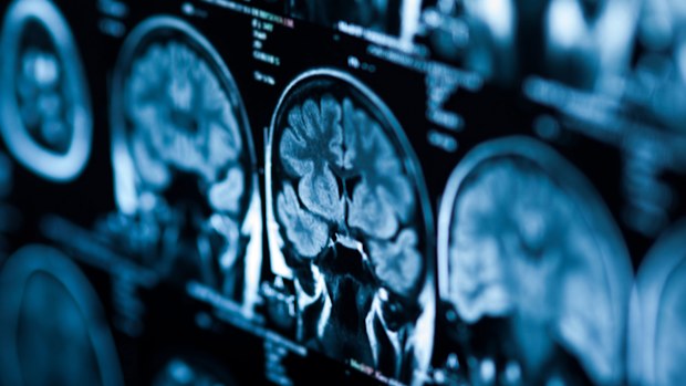 Brain scans