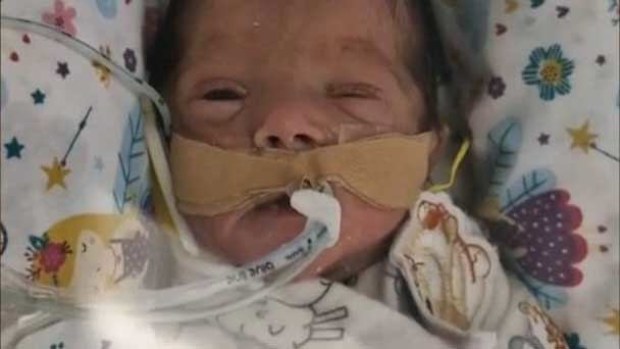 When Chris Breen and his wife lost their baby when she was just six weeks old, they needed time to grieve.But while Breen, 55, was still able to take his planned three months of parental leave, his wife, who didn't want her name published, was forced back to work.