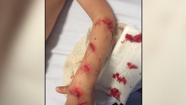 Cruz had several deep lacerations to his arms and body. 