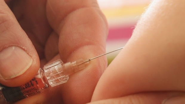 Three students at a leading Perth private school have contracted mumps and other children are being tested to contain the outbreak.
