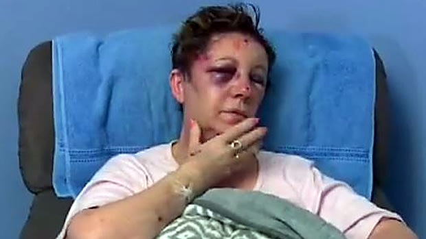 Mary was brutally assaulted in her Armadale home.