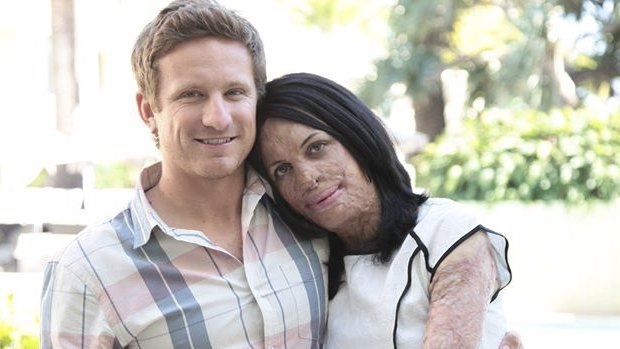 Turia Pitt with her partner Michael Hoskin.