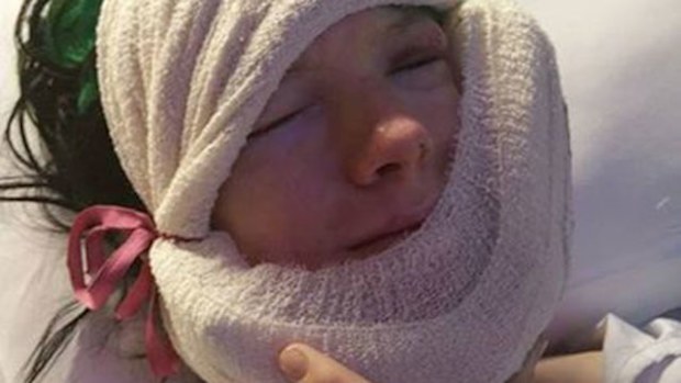 Jaidyn Lee, 17, after his surgery for a broken jaw and fractured cheekbone.