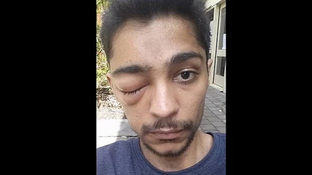 Hassan Asif was receiving end-of-life treatment for skin cancer.