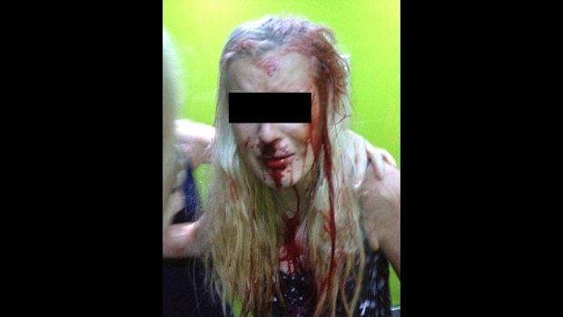 Izzy Ruger was left bloodied after allegedly being bashed by Kate Nicole Szepanowski with ceramic coffee mug. (Supplied)