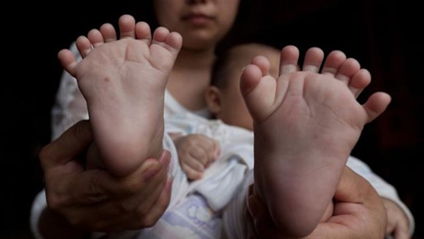Hong Hong's feet. (Getty)