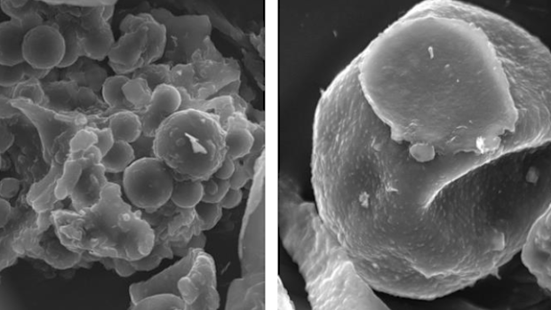 Mould and pollen pores found in homes