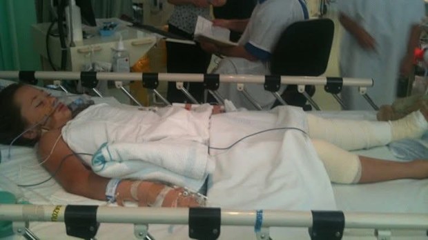 Rachael Shardlow was a victim of a severe box jellyfish sting when she was a child.