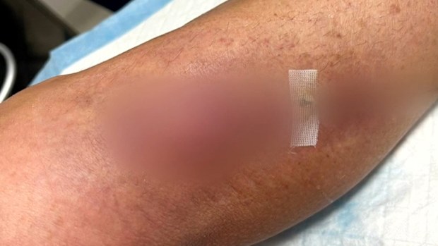 A Sydney woman was left unable to work for months after she was attacked by a kangaroo while trying to rescue a joey stuck in a fence in NSW's Blue Mountains.Melanie Stubbs, from Campbelltown, had been hiking in the Megalong Valley near Katoomba with friends in December when the group spotted a joey hanging from a wire fence by its back legs.