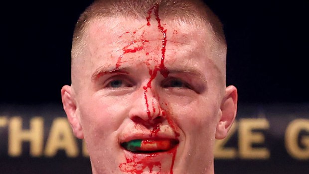 Paul Hughes, Usman Nurmagomedov ile dövüştükten sonra kanıyor.