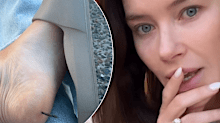 Brittany Hockley reveals gruesome foot injury