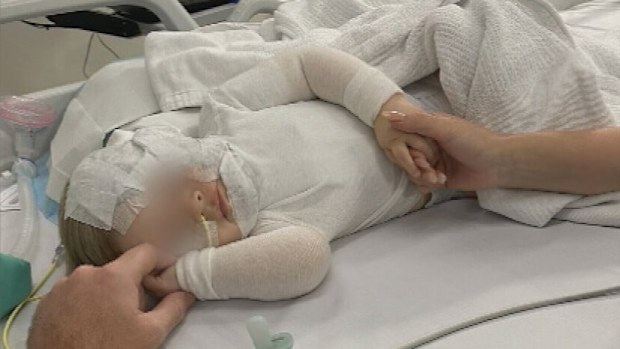 Australians are rallying around the family of a baby boy who is recovering from horrific burns from a random attack in a Brisbane park.