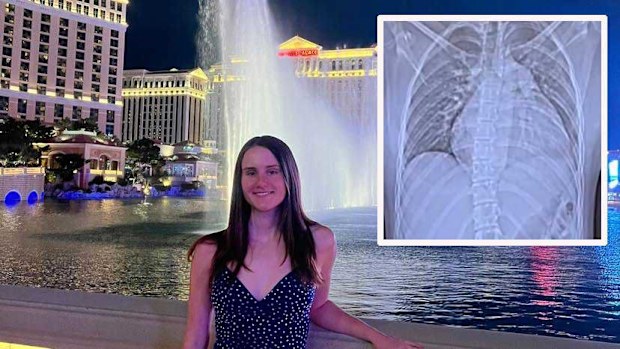 Paris Hedger was on the trip of a lifetime in the US when she became critically ill.