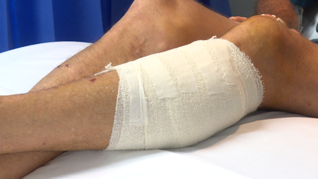 The Millner man was successful in getting the shark up onto the landing, but when he grabbed it by the tail, it swung around and latched onto his leg. 
