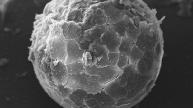 Pollen found in homes